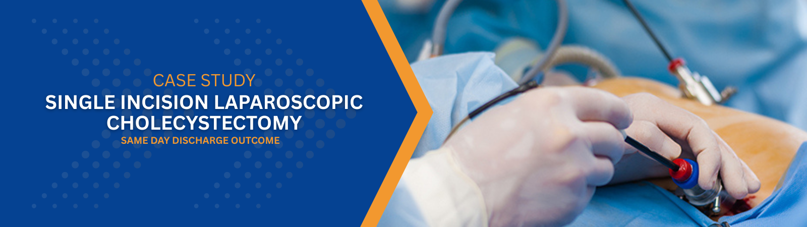 Single Incision Laparoscopic Cholecystectomy