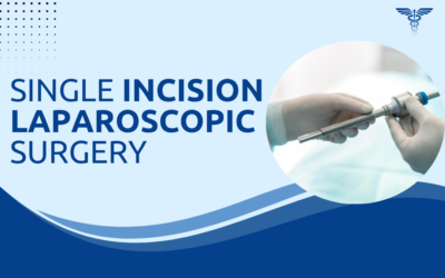 What Is Single Incision Laparoscopic Surgery?