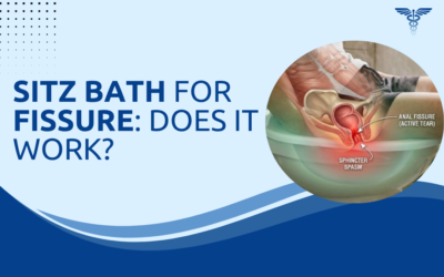 Sitz Bath for Fissure: Does It Work?