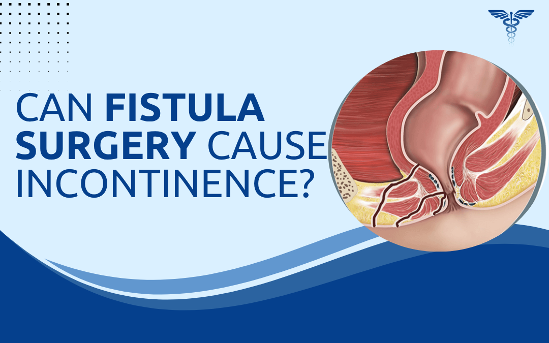 Can Fistula Surgery Cause Incontinence