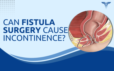 Can Fistula Surgery Cause Incontinence?