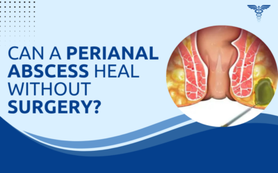 Can a Perianal Abscess Heal Without Surgery?