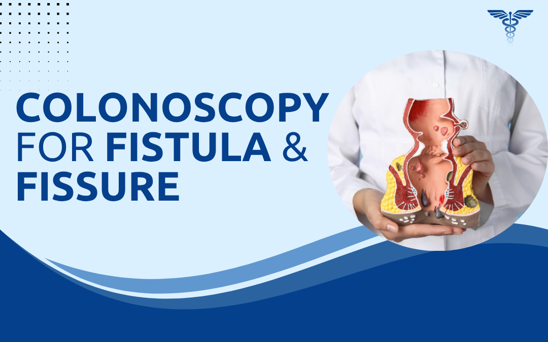 Colonoscopy for Fistula & Fissure