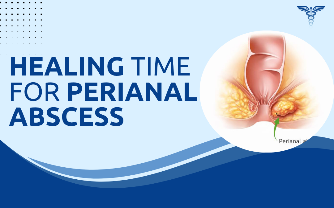 Healing Time for Perianal Abscess