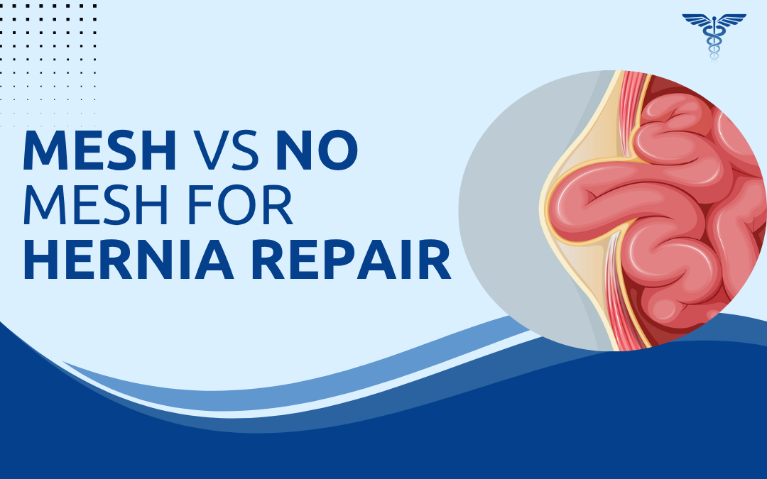 Mesh vs No Mesh for Hernia Repair