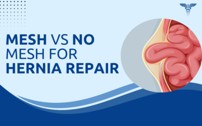 Mesh vs No Mesh: Which Is Better for Hernia Repair?