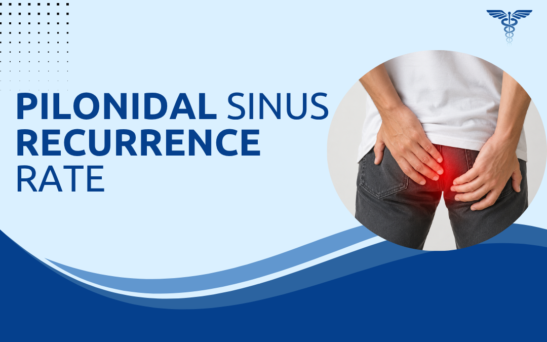 Pilonidal Sinus Recurrence Rate