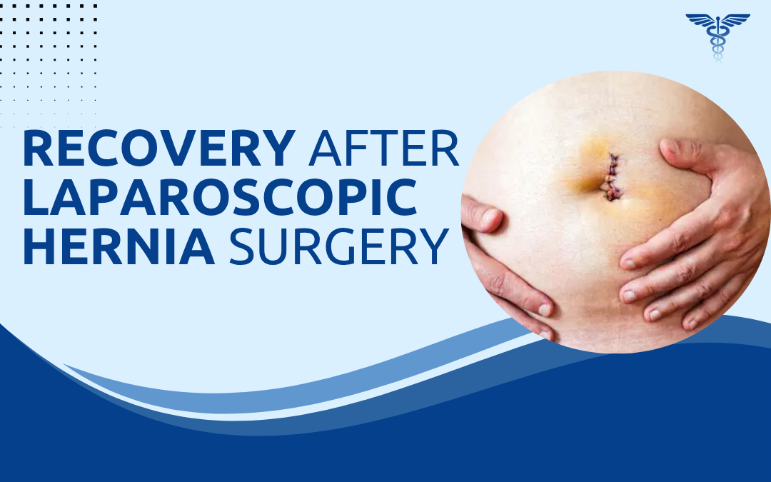 Recovery After Laparoscopic Hernia Surgery