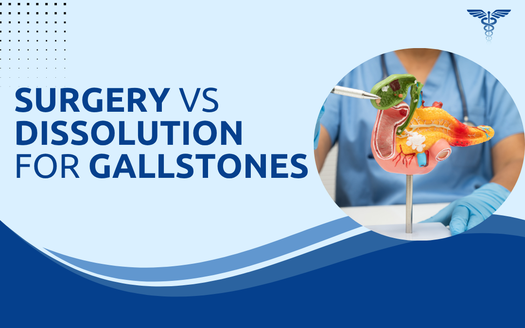 Surgery vs Dissolution for Gallstones