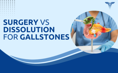 Gallbladder Surgery vs Stone Dissolution: Which Is Better?