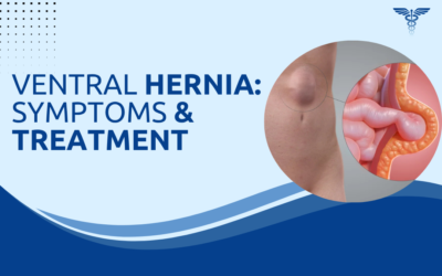 What Is a Ventral Hernia and How Is It Treated?