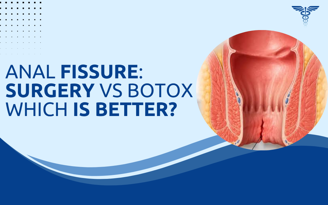 Anal Fissure Surgery vs Botox Which Is Better