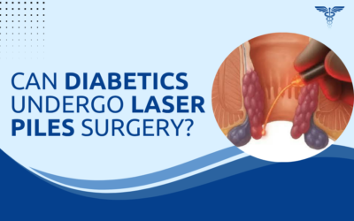 Can Diabetics Undergo Laser Piles Surgery Safely?