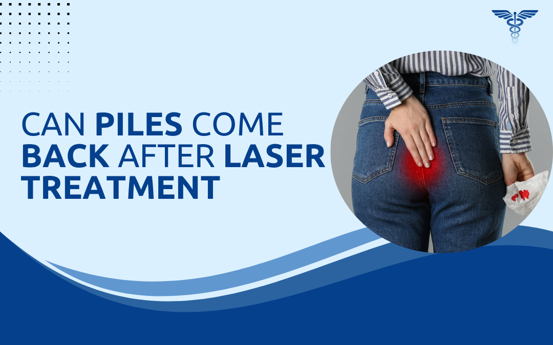 Can Piles Come Back After Laser Treatment