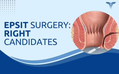 What Is EPSiT Surgery and Who Is the Right Candidate?