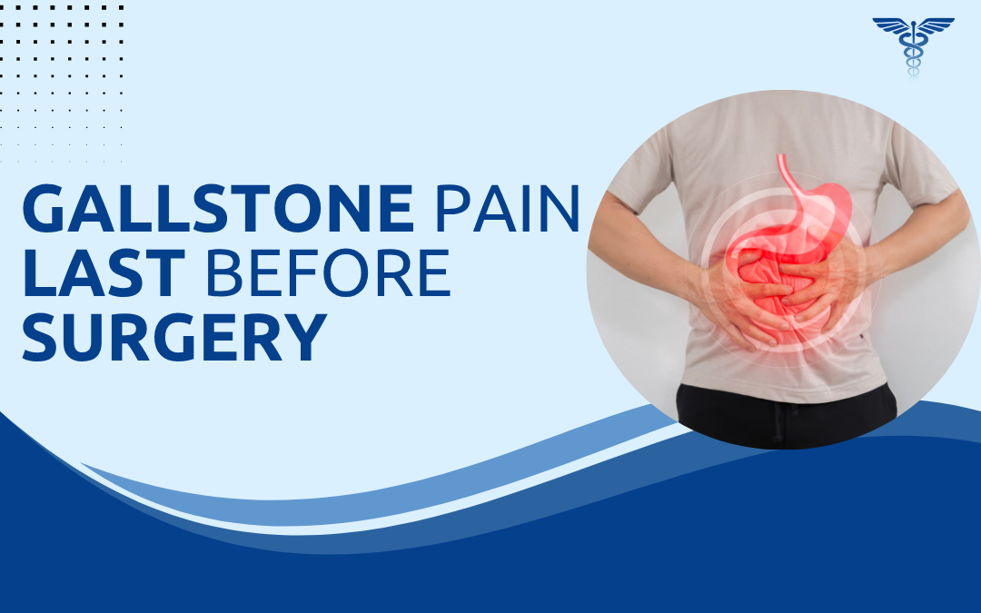 Gallstone Pain Last Before Surgery