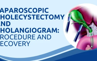 Laparoscopic Cholecystectomy and Cholangiogram: Procedure and Recovery