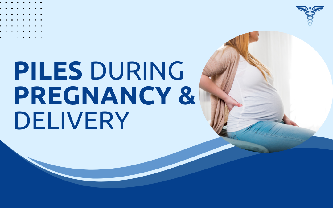 Piles During Pregnancy & Delivery