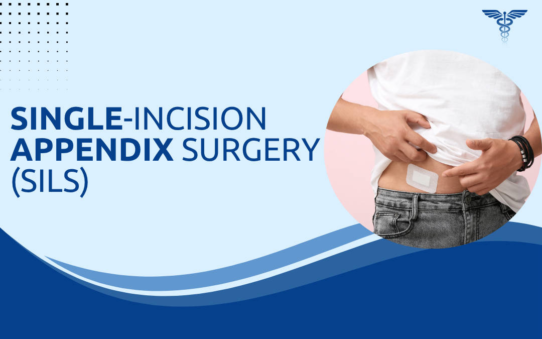 Single-Incision Appendix Surgery (SILS)