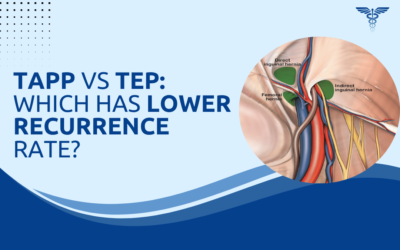 TAPP vs TEP: Which Has Lower Recurrence Rate?