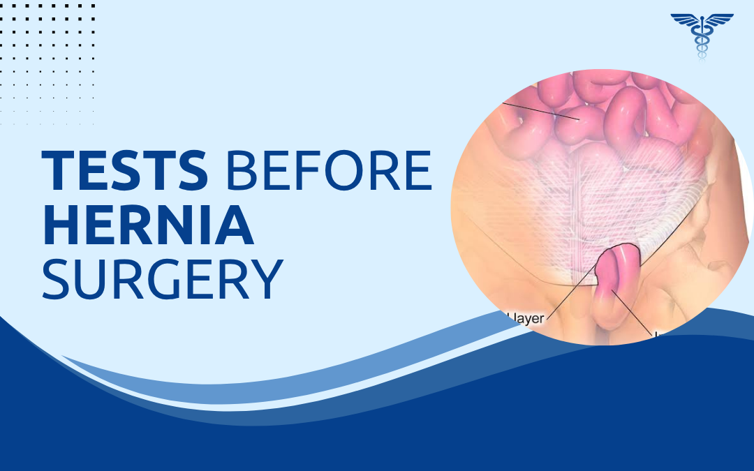 Tests Before Hernia Surgery