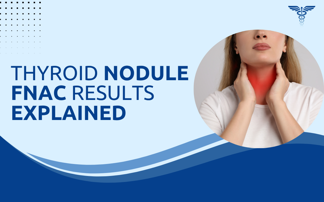 Thyroid Nodule FNAC Results Explained