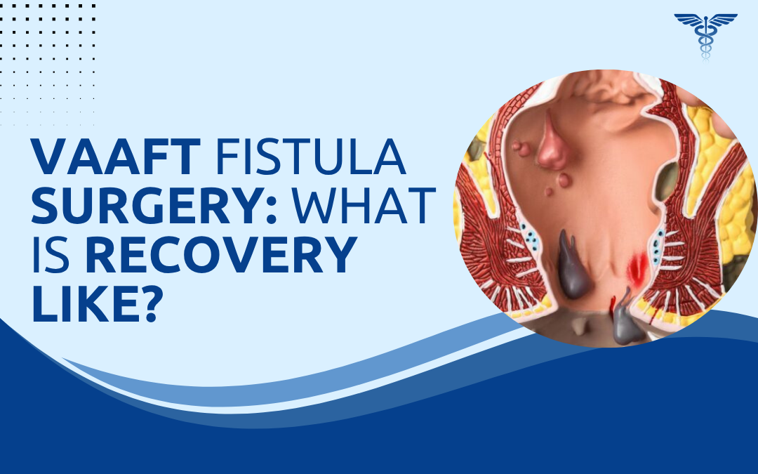 VAAFT Fistula Surgery What Is Recovery Like