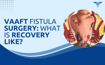 VAAFT Fistula Surgery: What Is Recovery Like?