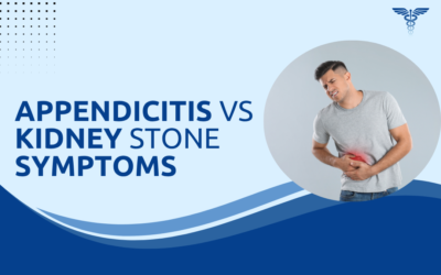 Can Appendicitis Symptoms Mimic a Kidney Stone?