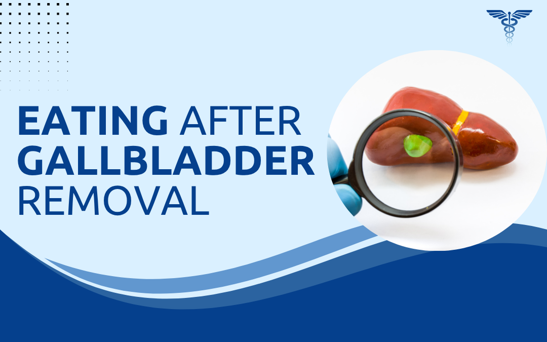 Eating After Gallbladder Removal