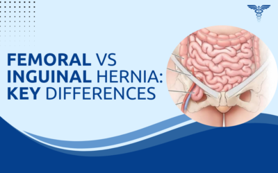 Femoral Hernia vs Inguinal: What Is the Difference?