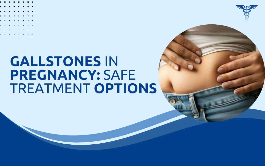 Gallstones in Pregnancy Safe Treatment Options