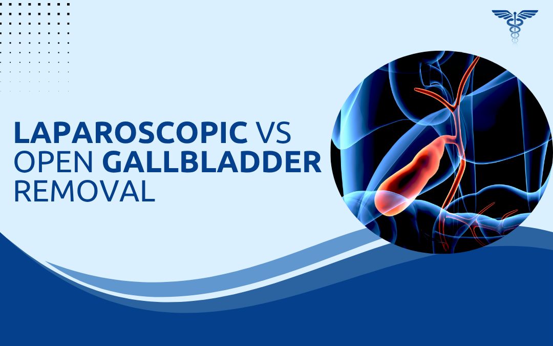 Laparoscopic vs Open Gallbladder Removal