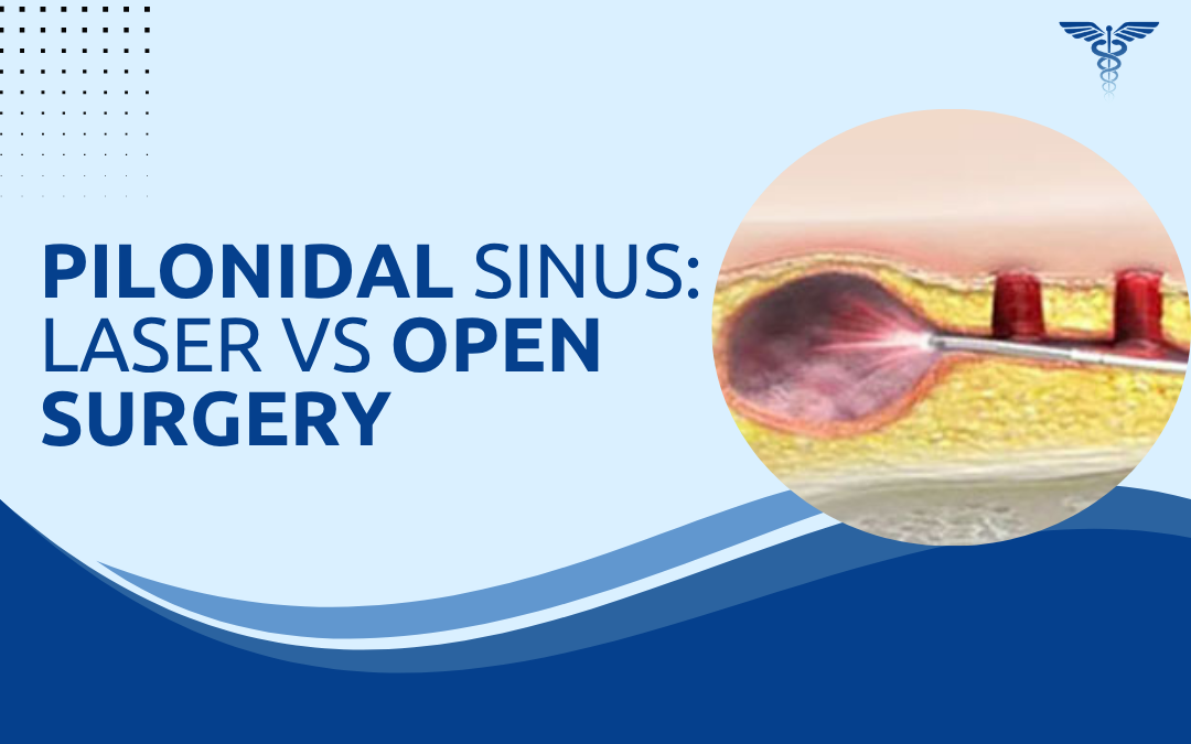 Pilonidal Sinus Laser vs Open Surgery