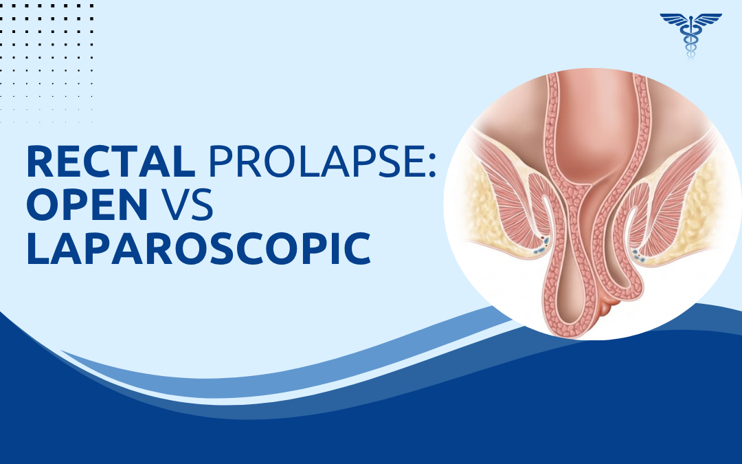 Rectal Prolapse Open vs Laparoscopic