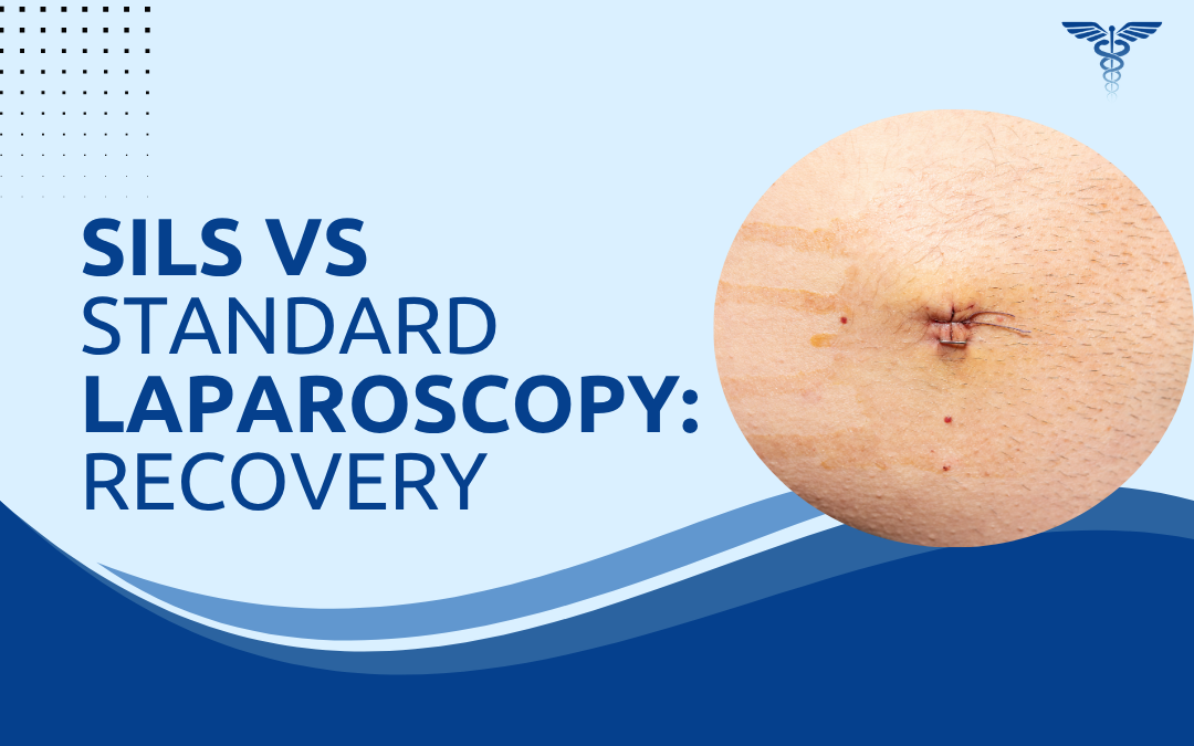 SILS vs Standard Laparoscopy Recovery