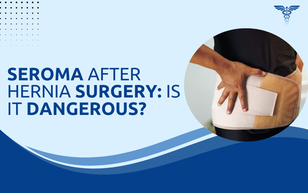Seroma After Hernia Surgery Is It Dangerous