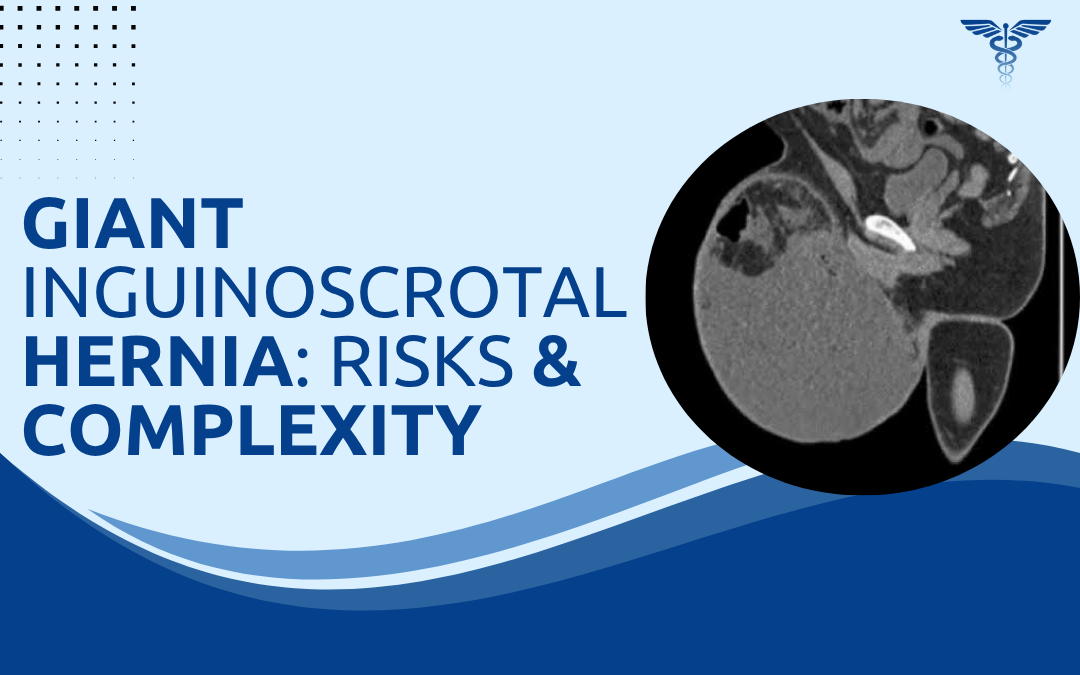 Giant Inguinoscrotal Hernia Risks & Complexity