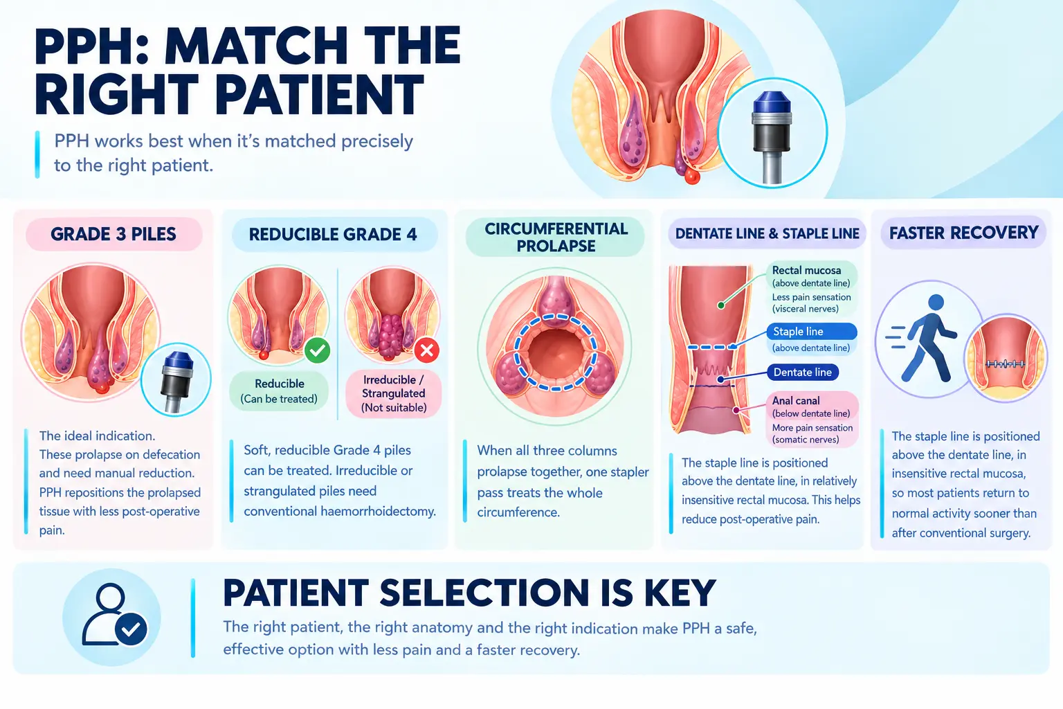 PPH Match the Right Patient PPH Match the Right Patient