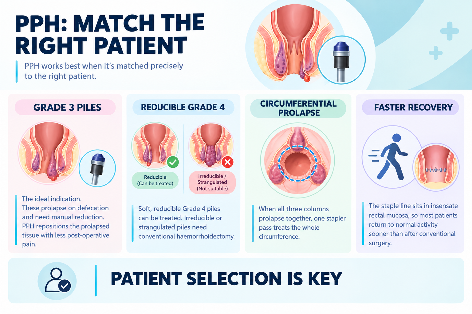 PPH Patient Selection Infographic Rectal Bleeding Causes Infographic