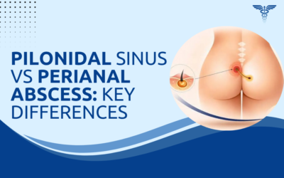 Pilonidal Sinus vs Perianal Abscess: What Is Different?