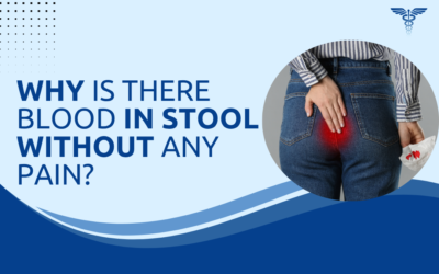 Why Is There Blood in Stool Without Any Pain?